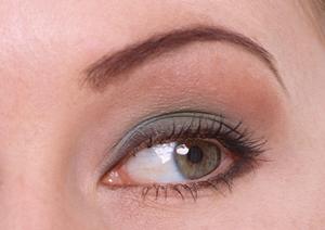 何歳からでも歯列矯正は可能です